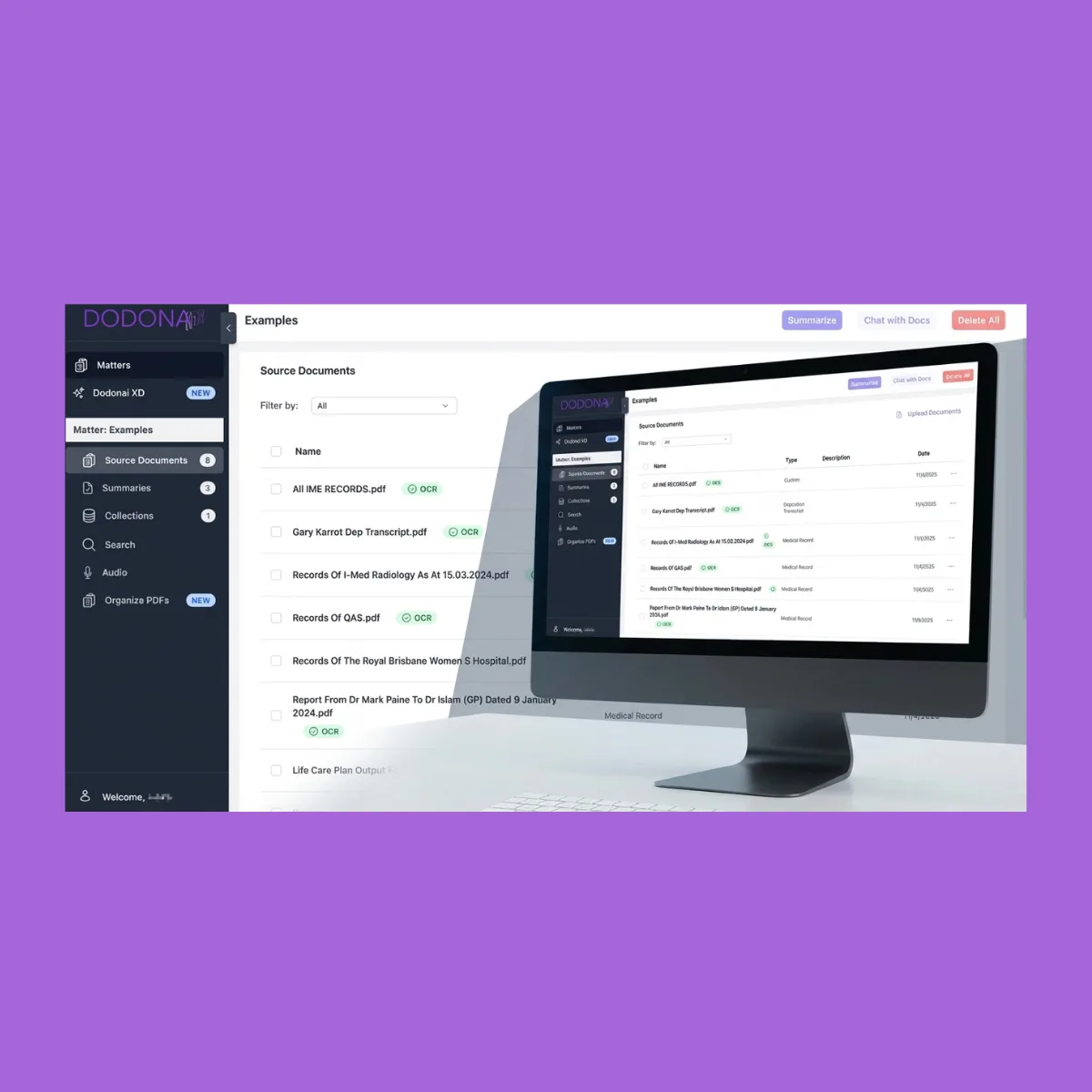 Finding contradictions in deposition transcripts